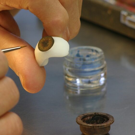 Pigmentazione dell'iride