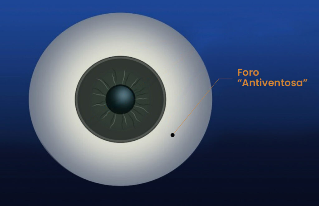 Foro_antiventosa